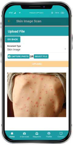 Dermatology Image Scan